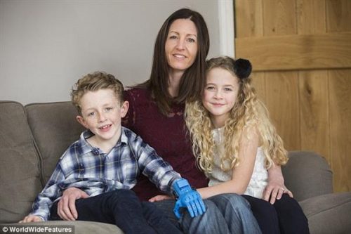 Niềm vui từ những chiếc tay giả 3D Niềm vui từ những chiếc tay giả 3D