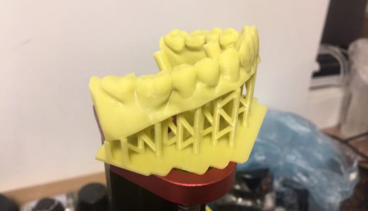 in 3D mẫu hàm răng dùng trong nha khoa
